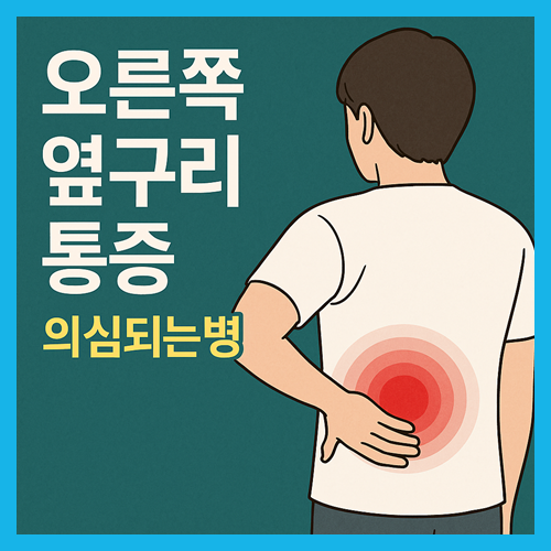 오른쪽 옆구리 통증 의심되는병