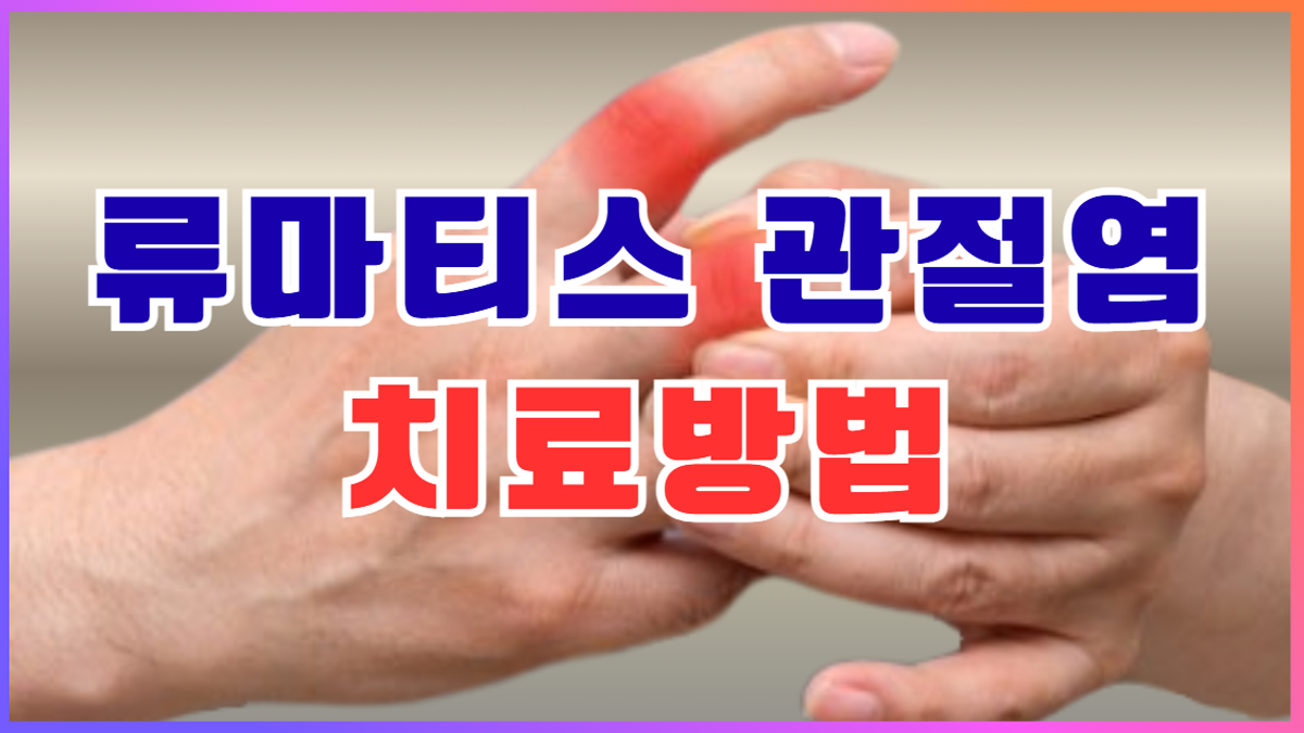 류마티스 관절염 치료방법을 안내하는 대표 이미지, 손가락 관절 통증 표현