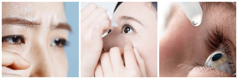 안구 건조, 눈에 안약 넣는 사진