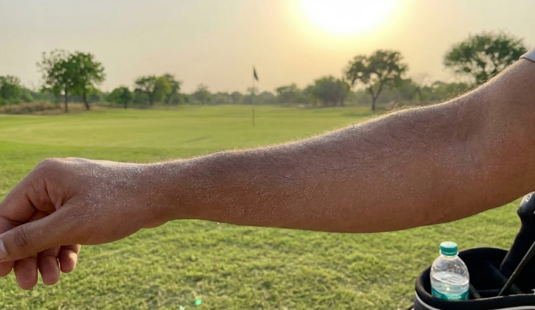 골프치고 나면 팔에 저렇게 하얗게 소금이 만져집니다.