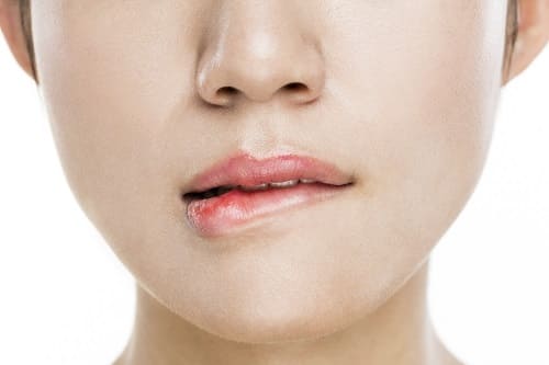 피부-트러블-스트레스