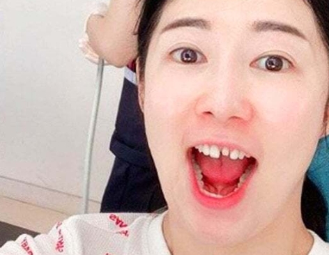 덧니-라미네이트-부작용