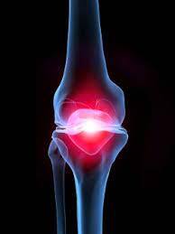 무릎보호대 효과 부작용 (내돈내산 추천)