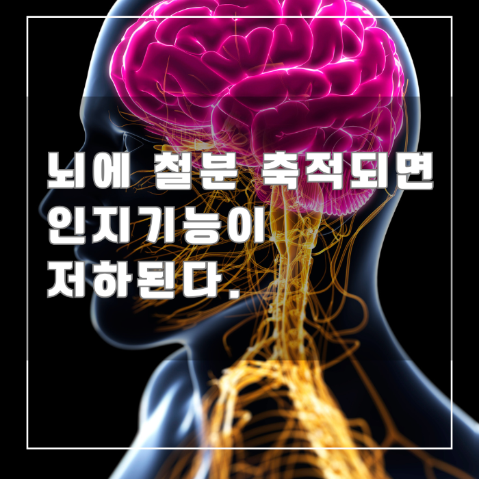 뇌에 철분 축적