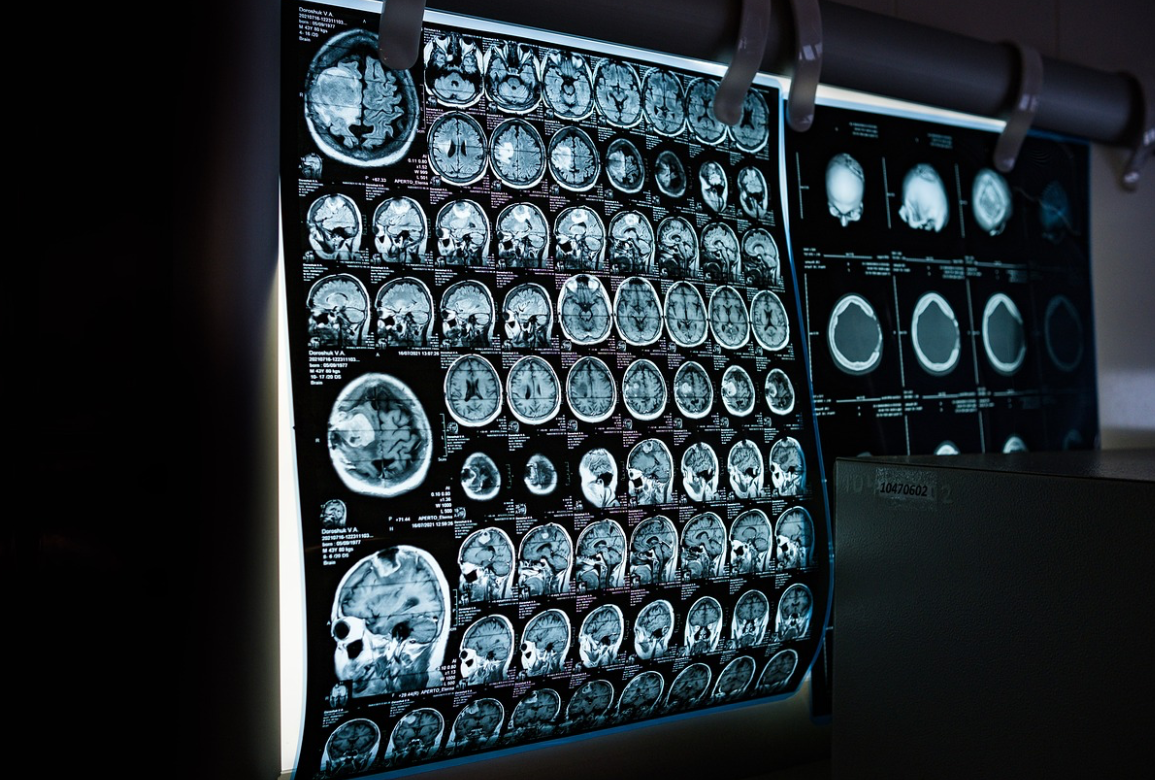 AI 기반 헬스케어 혁명: 의료의 미래를 바꾸는 기술들
