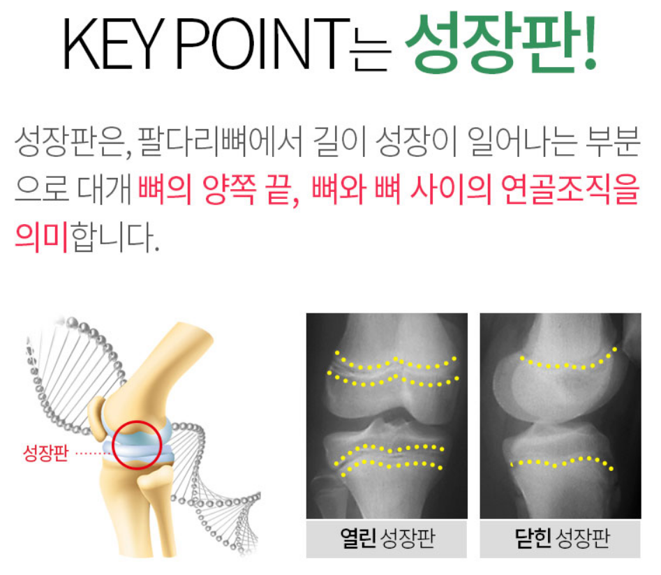 키올리효과