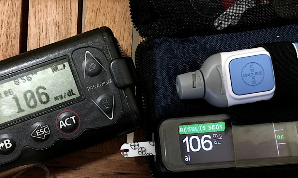 당뇨병 진단, 검사