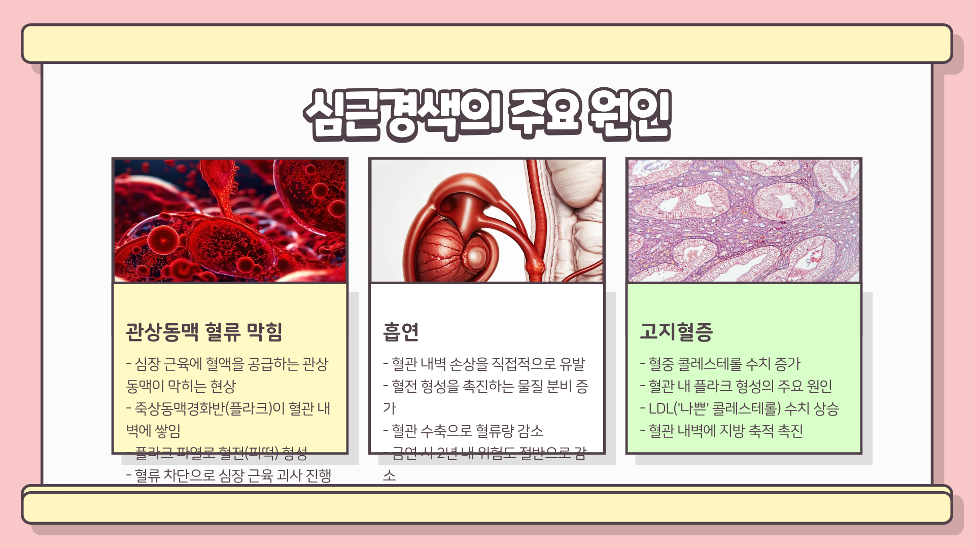 심근경색이란? 심근경색 전조증상 &amp;#124; 심근경색 초기증상 &amp;#124; 심근경색 원인 총정