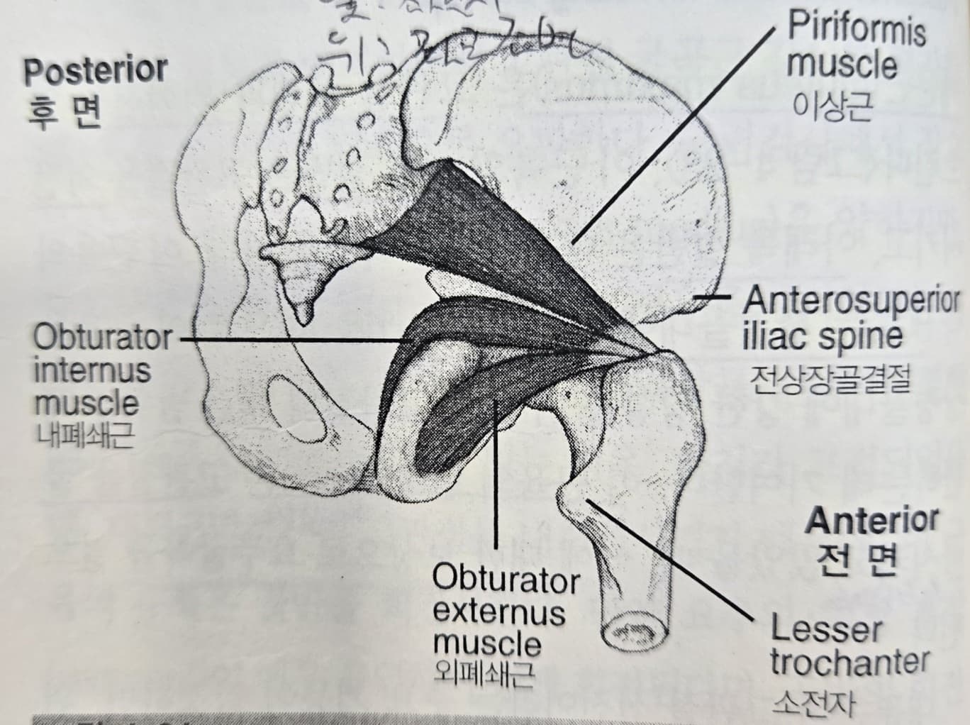고관절 외회전 증후군 (Hip Lateral Rotation Syndrome)