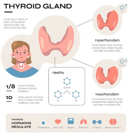갑상선 기능 항진증에 대해 설명하는 그림