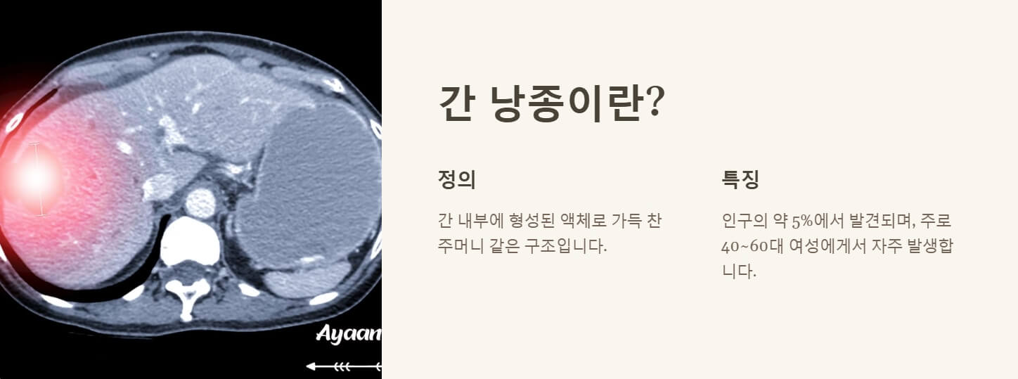 간에 물혹이 생기는 이유