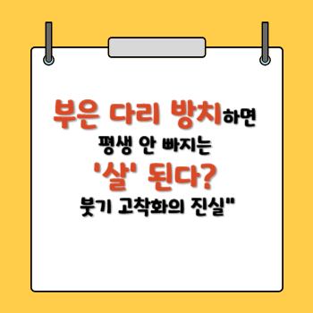 부은다리 부종 방치하면 살된다