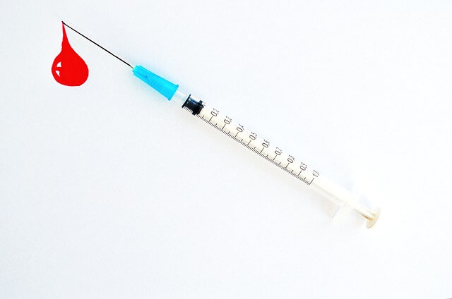 급성 경막하출혈