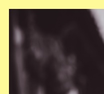 성홍열유행주의