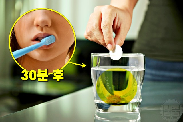발포비타민 먹고 바로 양치, 치아 부식, 팁줌