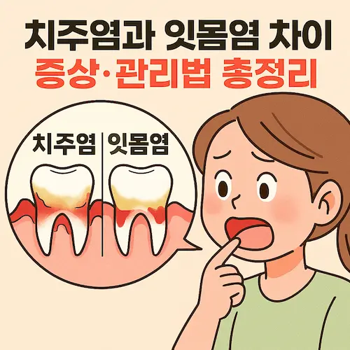 치주염 잇몸염 증상 비교