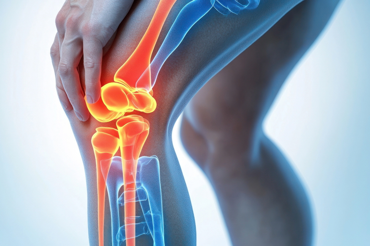 보스웰리아 효능