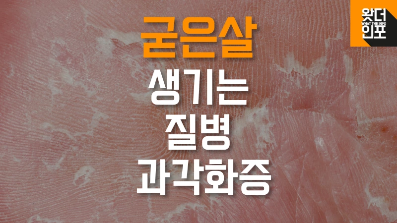 과각화증 섬네일 이미지