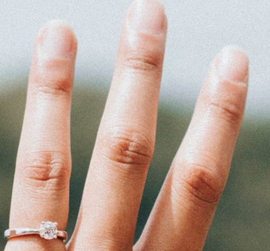 비오틴 효능 : 손톱