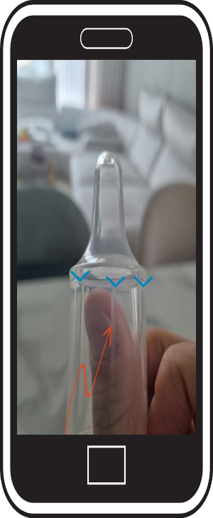 구순구개열 특수젖병 메델라 직접 사용 방법 후기