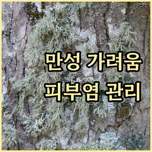 만성 가려움, 아토피 피부염 진단과 ..