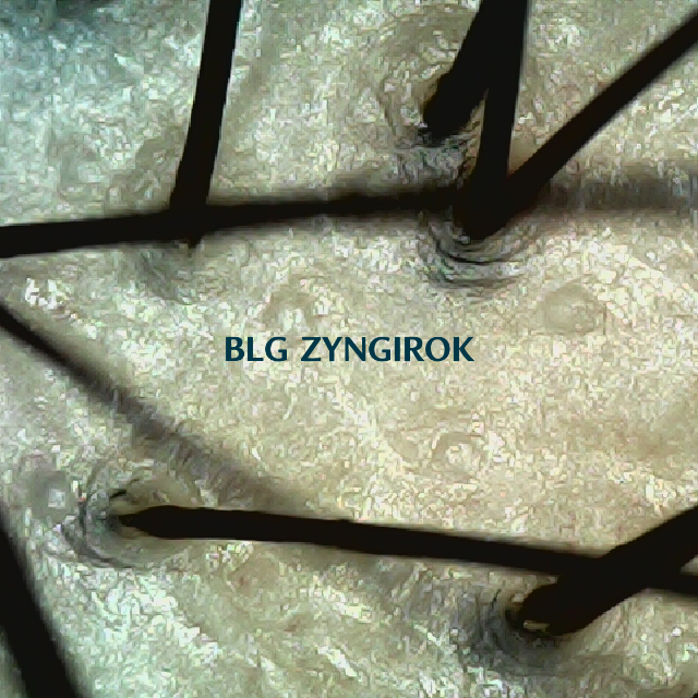 탈모 극복 프로젝트 - 정수리 두피 모습이다.