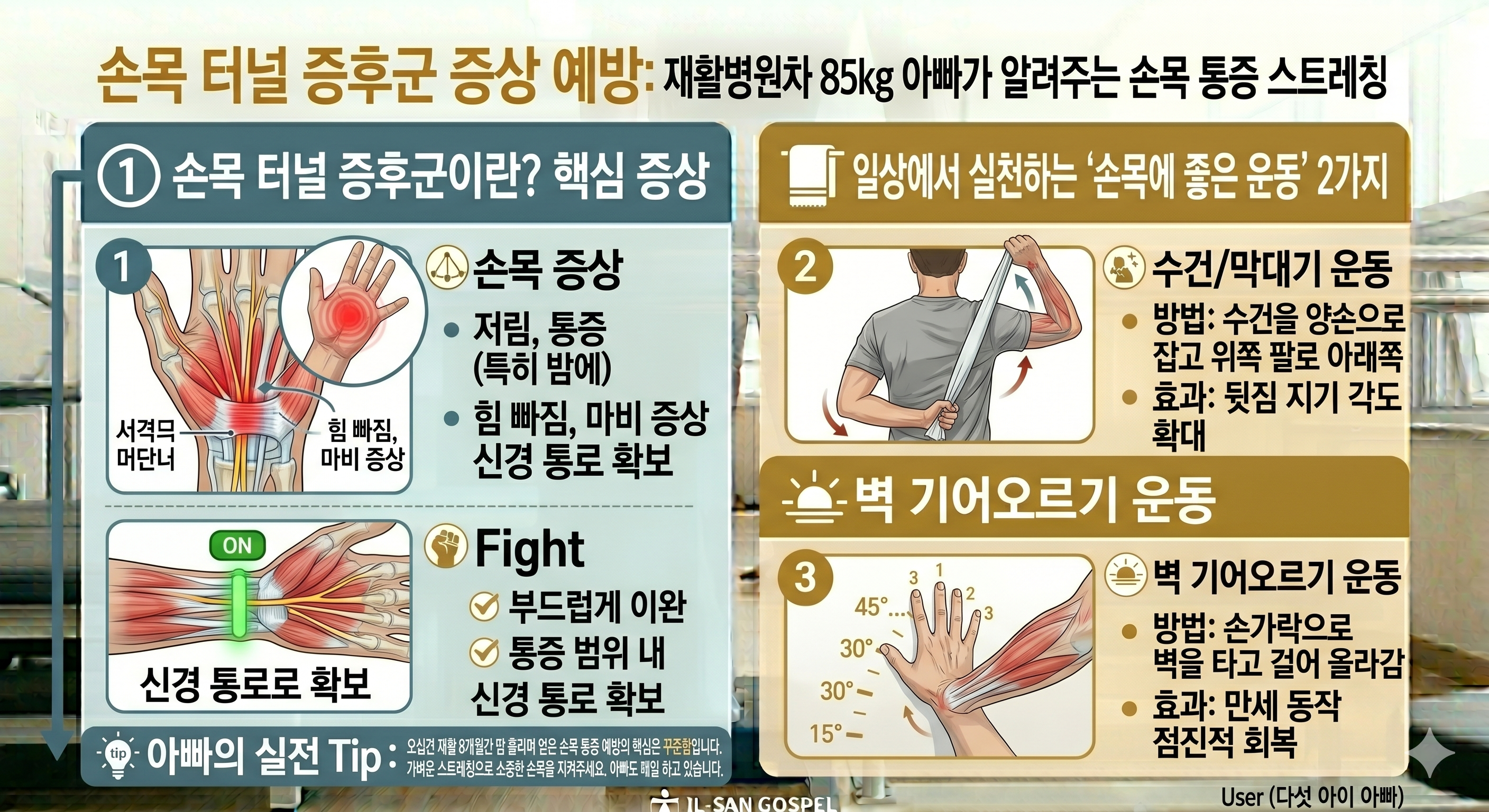 손목 터널 증후군 증상 예방: 재활병원 8개월 차 85kg 아빠가 알려주는 손목 통증 스트레칭