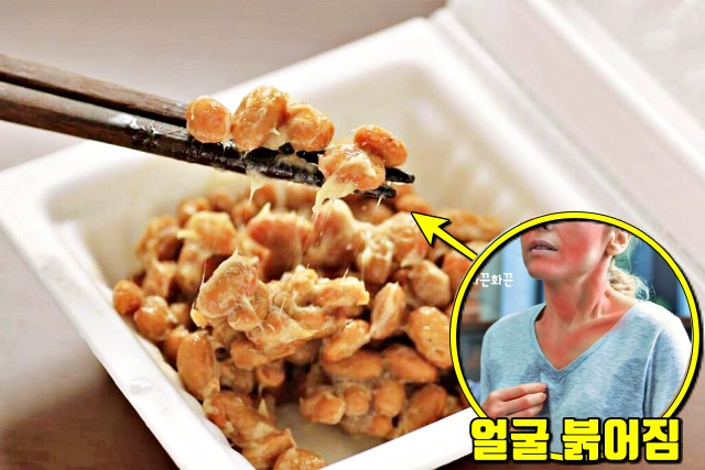 낫토 효능 여성 주부 갱년기 증상 좋은 식품 음식,건강 팁줌