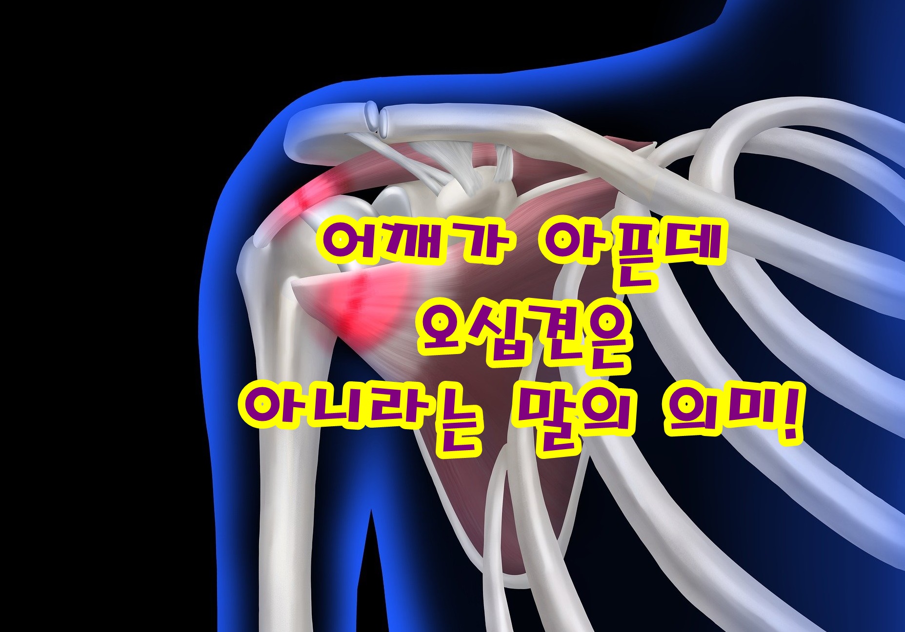 어깨가 아픈데 오십견은 아니라는 말의 의미!
