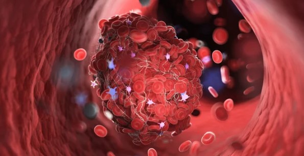 폴리코사놀 효능&amp;#44; 사탕수수가 중요한 이유&amp;#44; 나이가 들어 감에 따라 각종 질병에 노출되어 고혈압&amp;#44; 당뇨 등의 대사증후군을 일으키고 뇌심혈관질환으로 이어지게 됩니다.