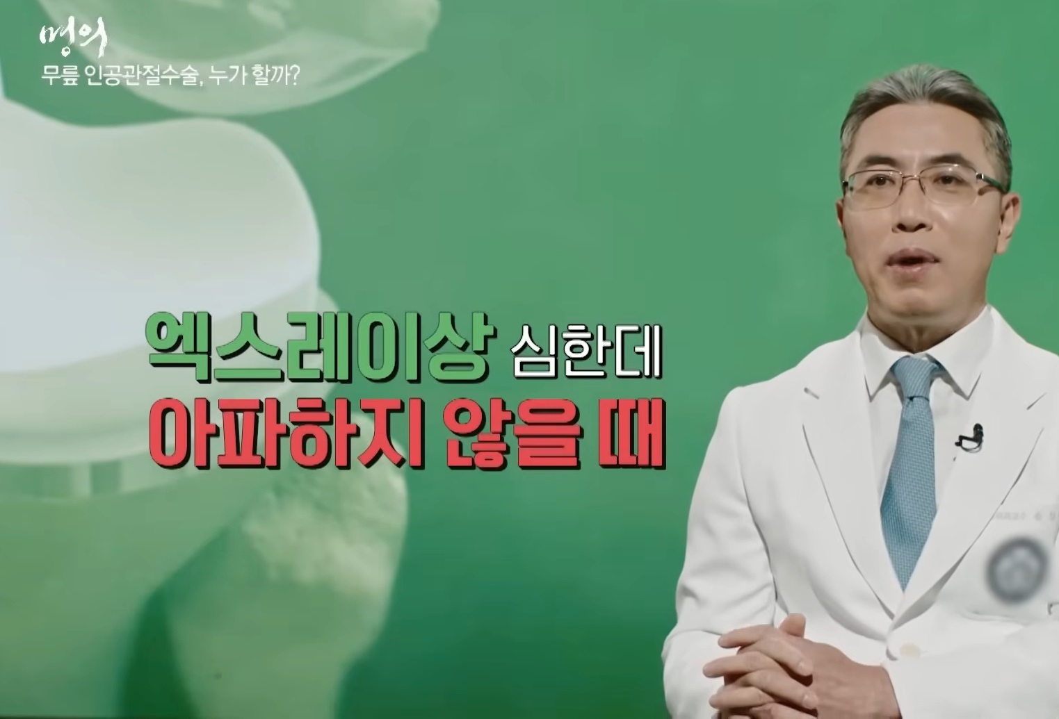 명의-무릎-김성환-교수