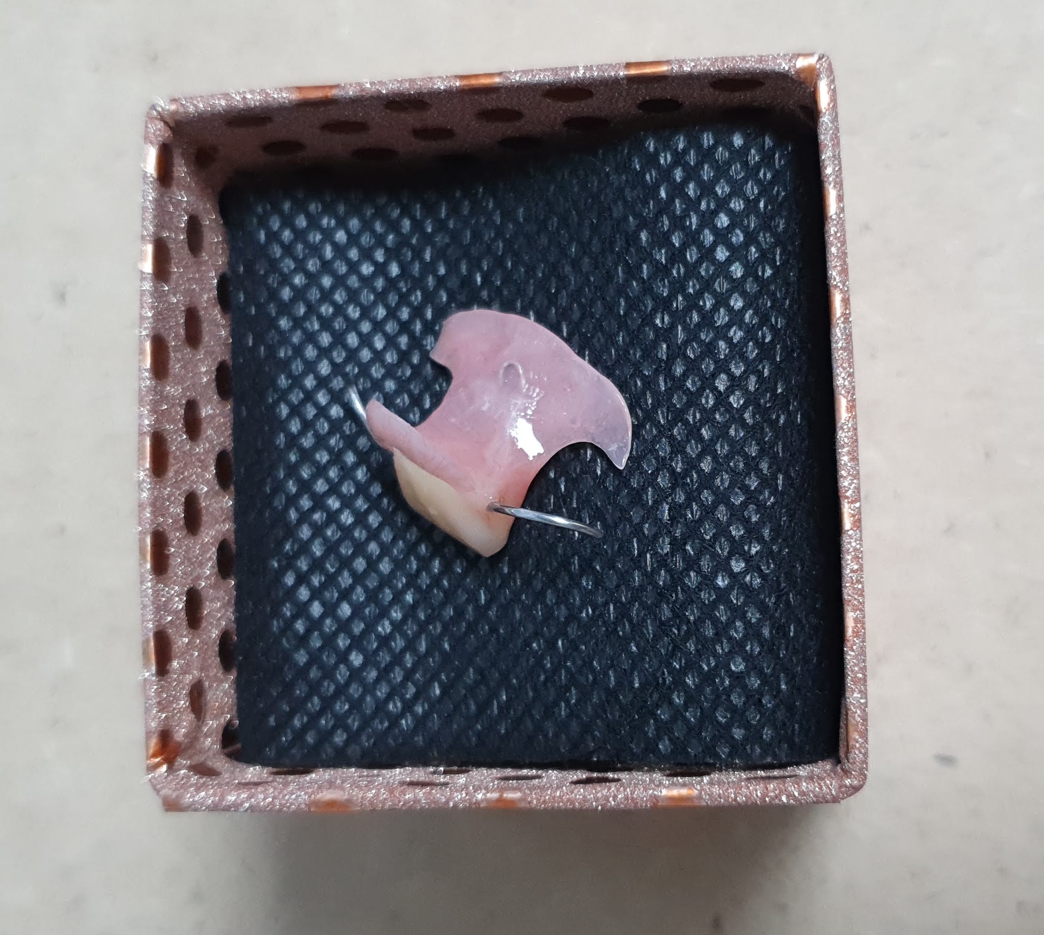 치과건강검진