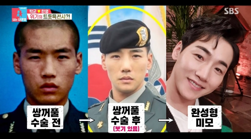 박군 성형전