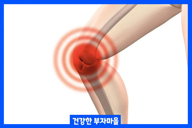 관절염 초기증상 4가지
