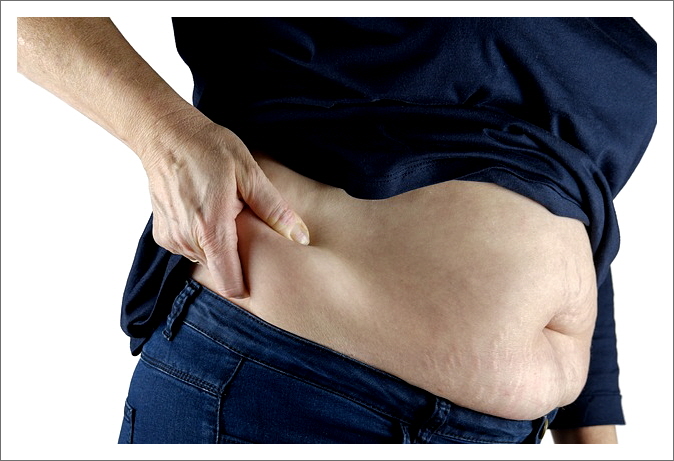 중성지방-비만-뱃살