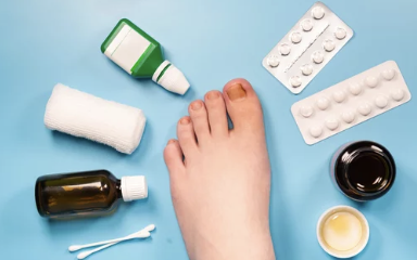 내성발톱 자가치료