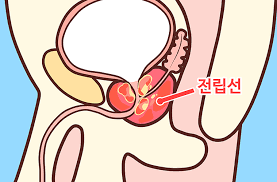 전립선염의 진단 방법