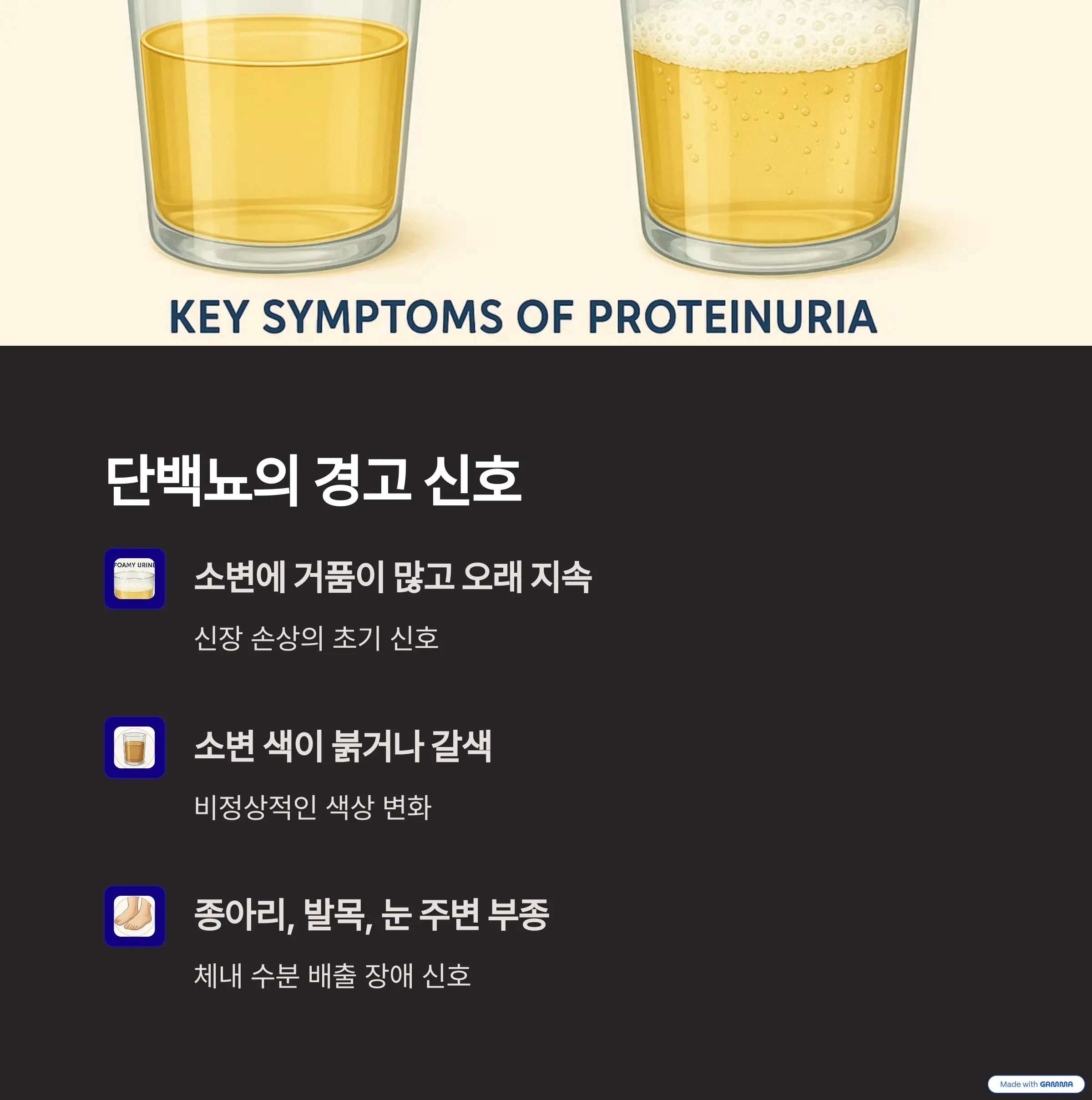 단백뇨 경고 신호 – 소변 거품, 색 변화, 부종에 대한 안내 이미지