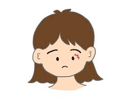 눈꺼풀 떨림 현상