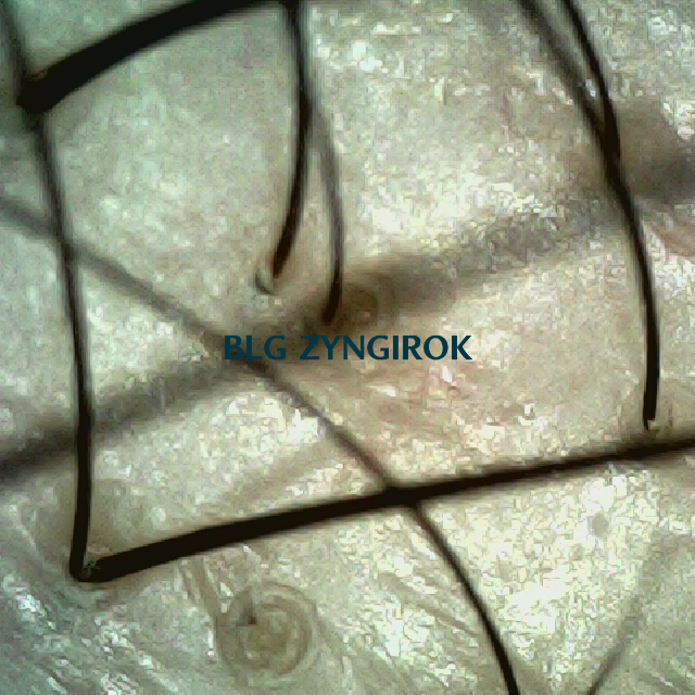 피나모아 복용 9주차 두피사진 - 정수리와 이마 사이 위치이다.