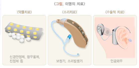 어지럽고 토할 것같은 증상