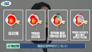 망막변성
