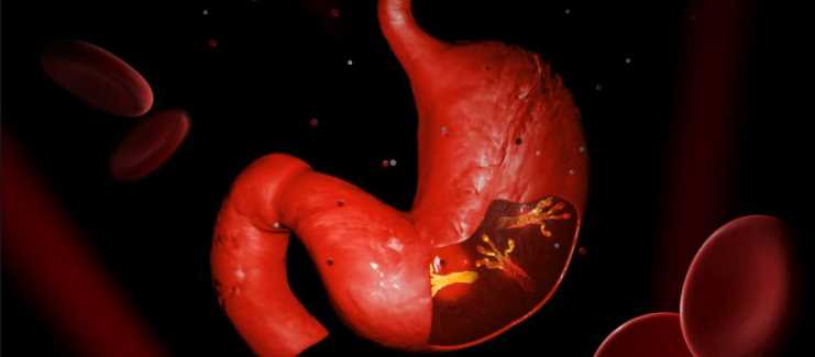 연근 효능 - 위장질환 개선 및 질환 예방