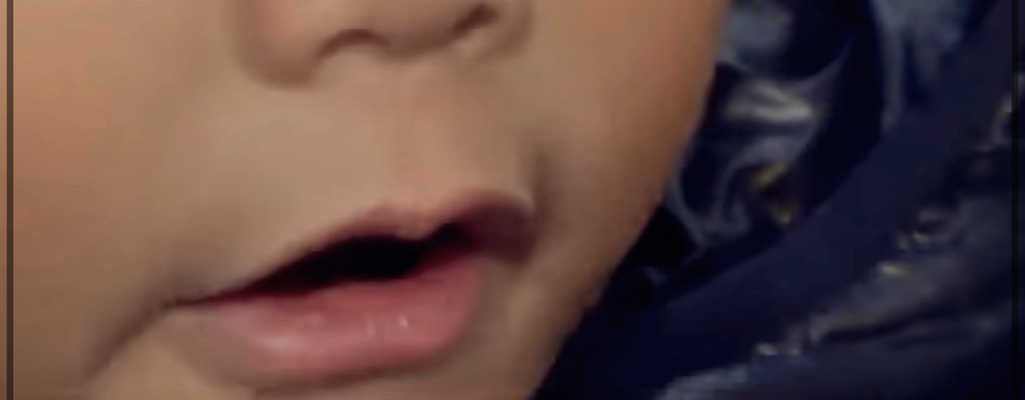 목젖 부음을 위한 빠른 해결책