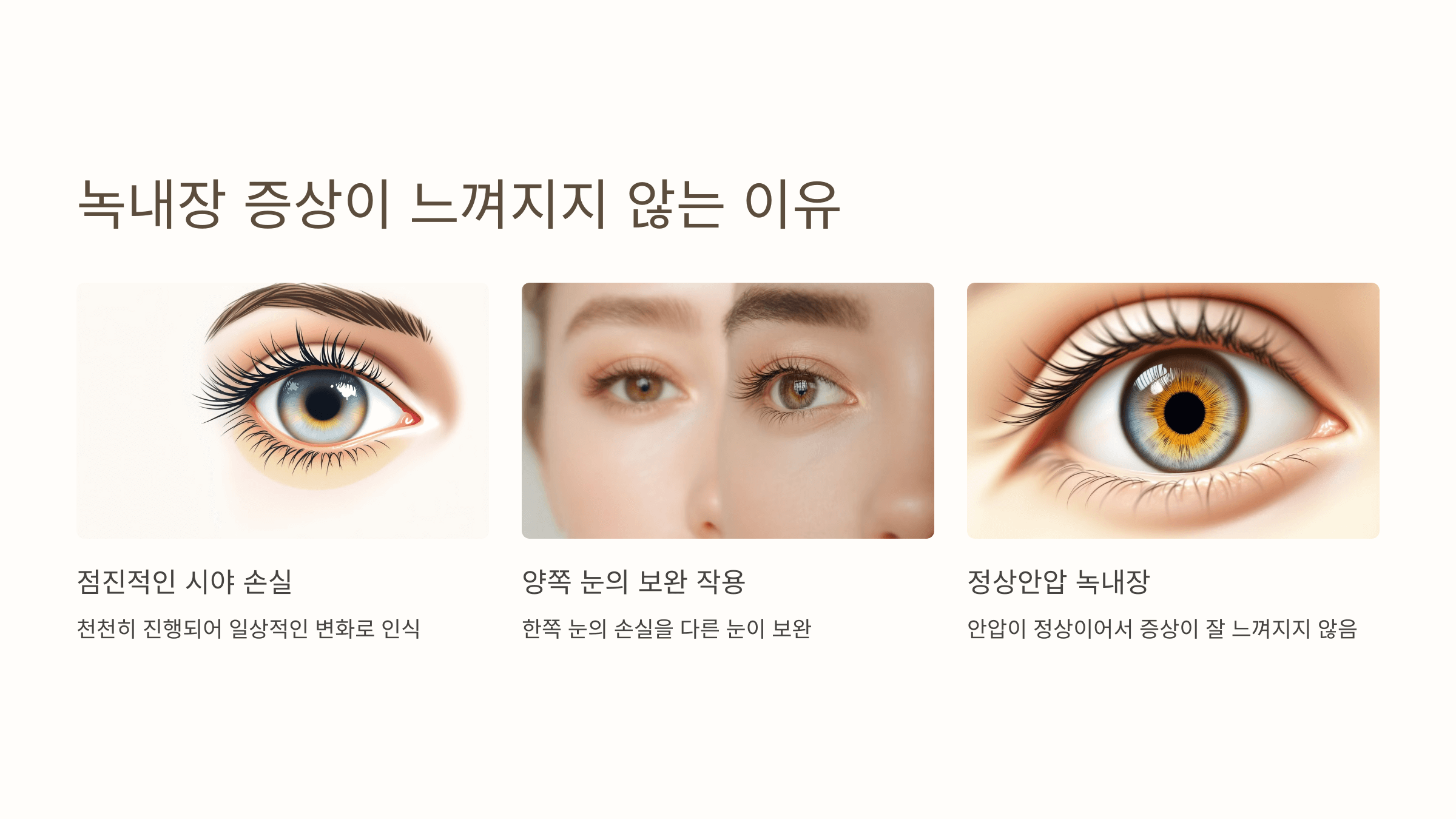 녹내장과 관련된 사진입니다.