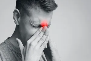 축농증-수술비용