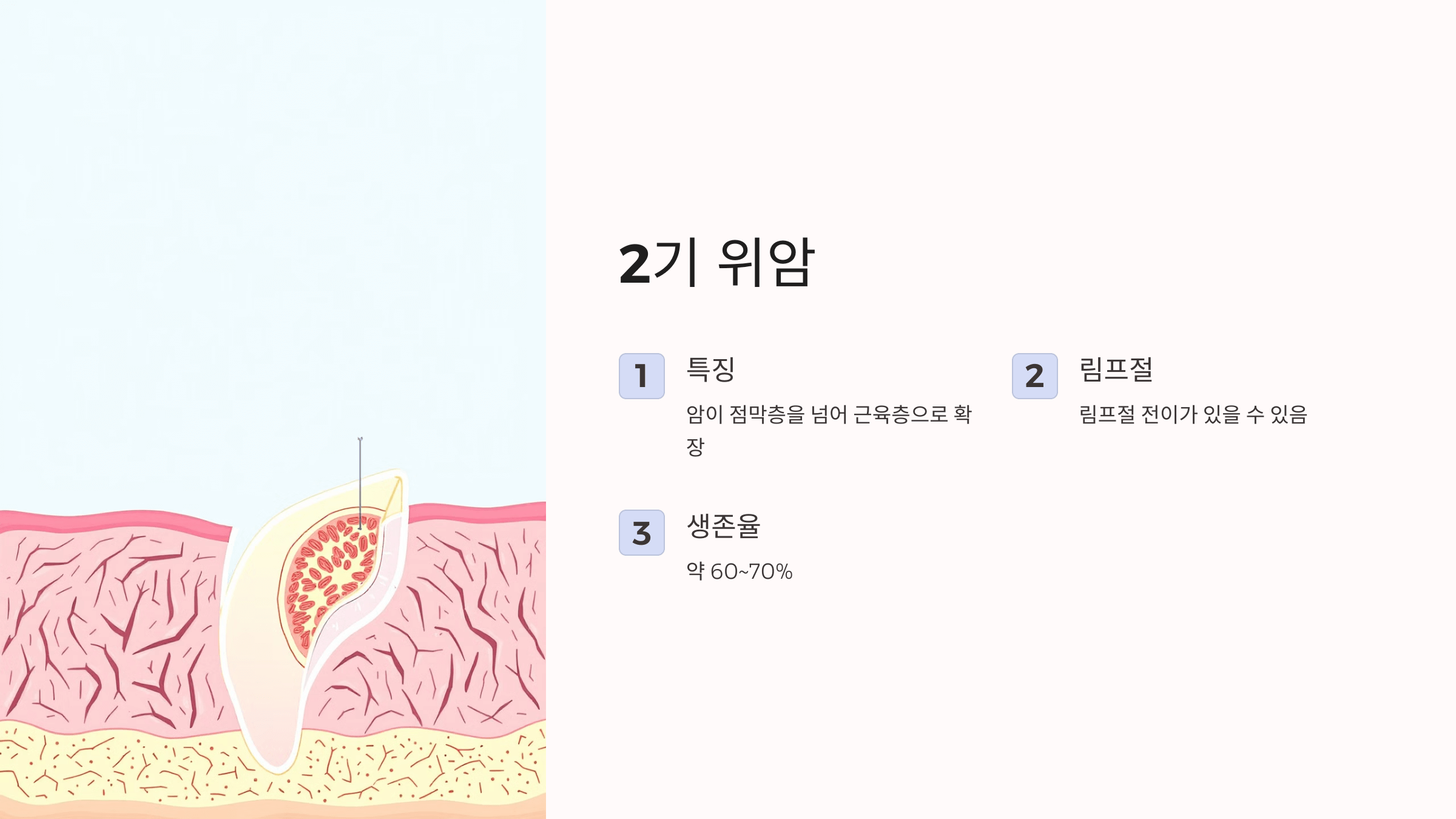 위암과 관련된 사진입니다.