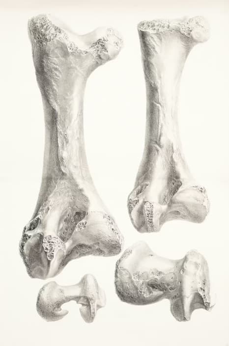 골밀도 검사 보험 적용 연령&middot;주기&middot;주의사항