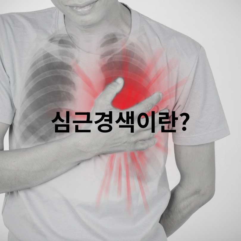 협심증과 심근경색의 결정적 차이