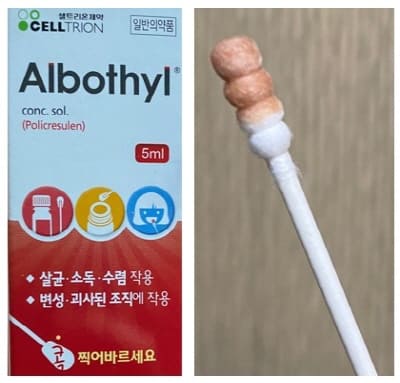 알보칠